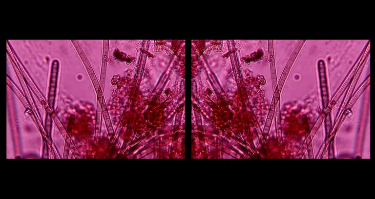 A Window into the Micro World, portfolio item 2